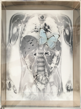 Mia Florentine Weiss: Me & You (X-Ray-Serie Plexikasten Oberkörper mit Schmetterling), 2017